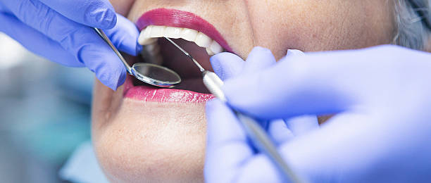 Best Emergency Dental Care for Broken or Chipped Teeth in Dothan, AL